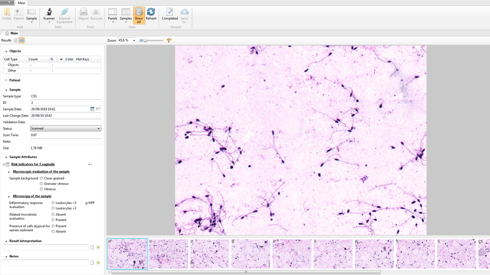 Vision Cyto Sperm Sediment Vision Cyto Sperm Sediment
