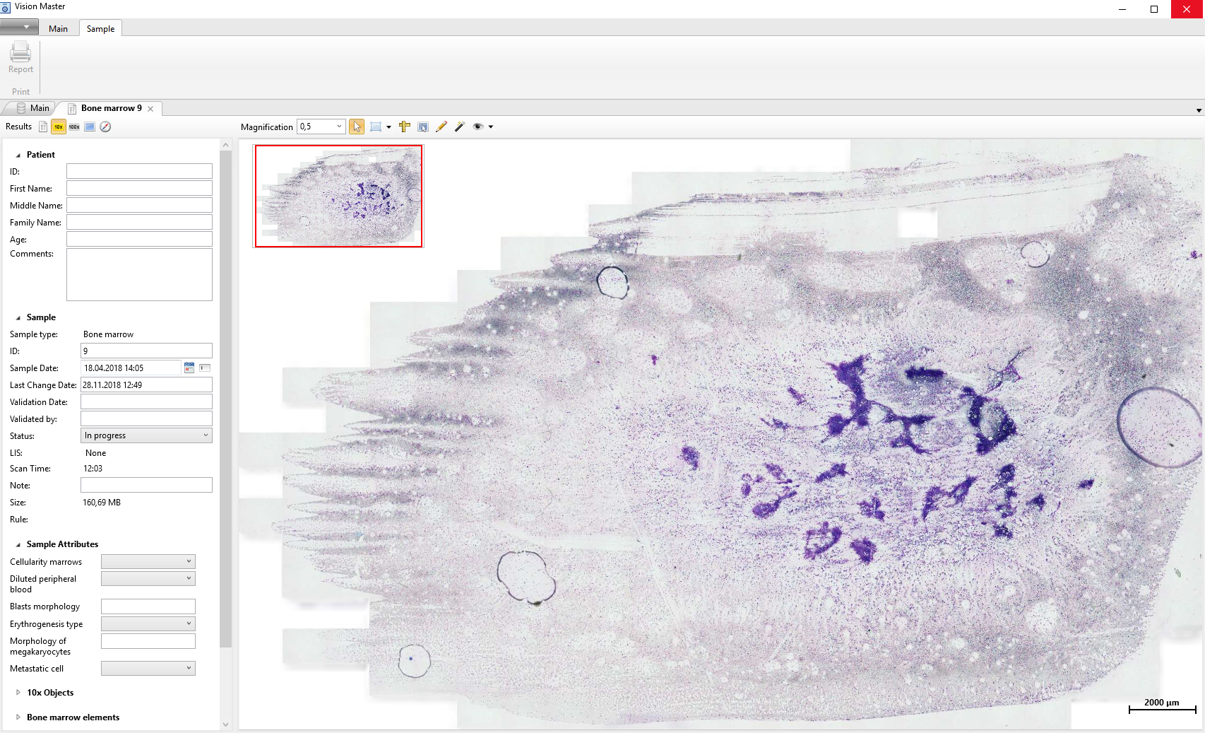 Digital slide of bone marrow.