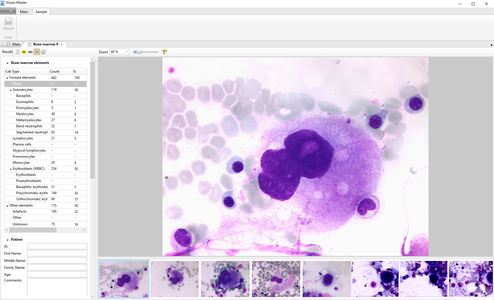 Megakaryocytes gallery.