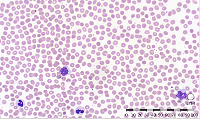 Analysis of erythrocytes