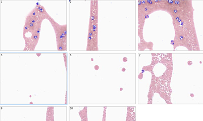 Scanning of blood smear tail»