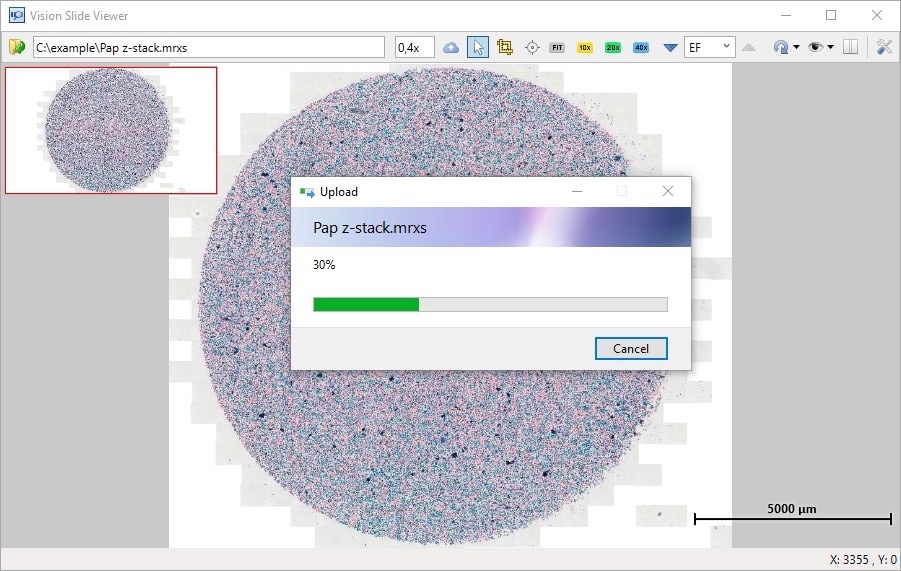 Upload to the Pathoview Service for consulting