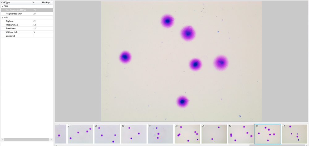 DNA fragmentation